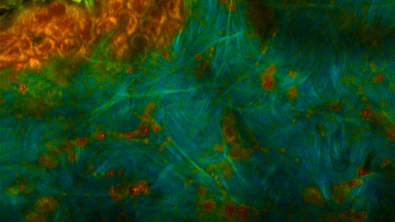 Mean two-photon excitation fluorescence lifetime (755nm excitation; 460nm emission) demonstrates contrast between cells (short lifetime in orange) and extracellular matrix (long lifetime in green/blue).  