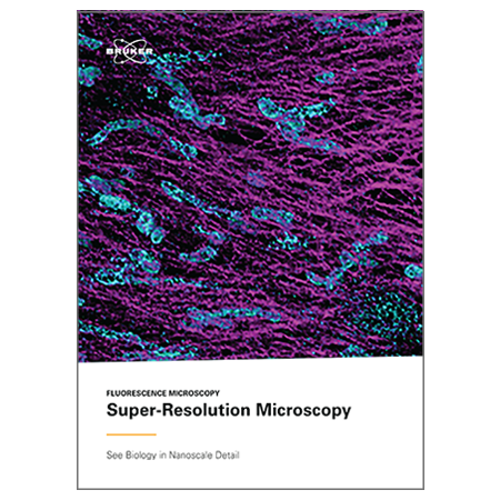 eBook Super-Resolution Microscopy cover image