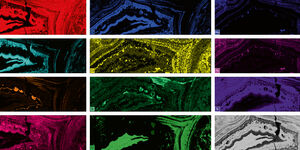 Micro-XRF analysis on a Scanning Electron Microscope (SEM)