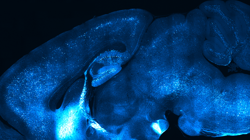 Bruker Online Neuroscience Summit 2025