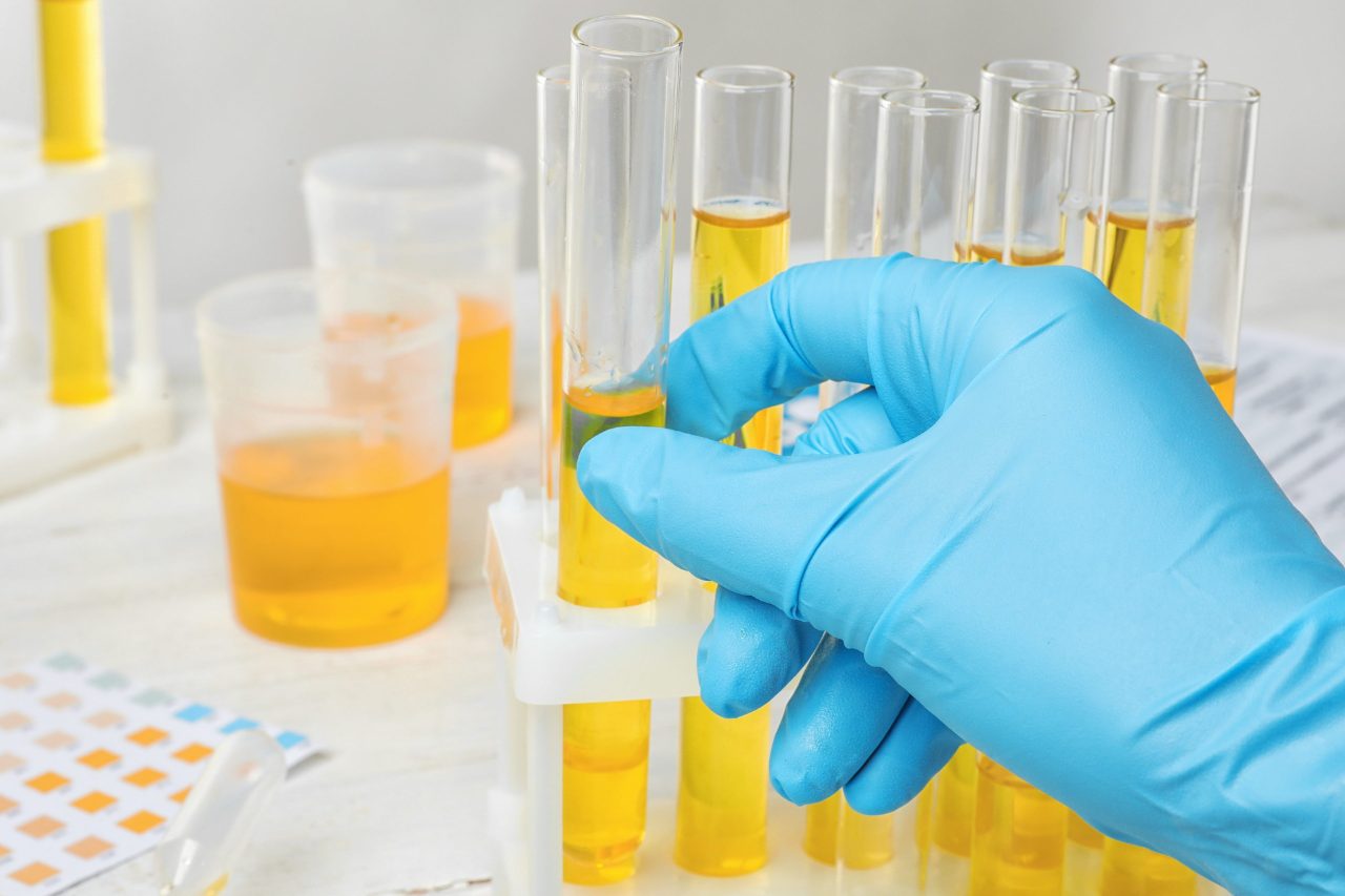 Metabolomics Research Insights