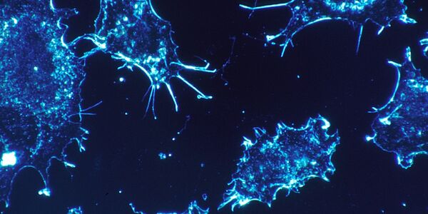 csm_cancer_cells_675c5a18a3
