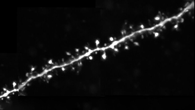 A_Spike-timing_depnedent_plasticity_rule_for_dentritic_spines_teaser-BRUKER