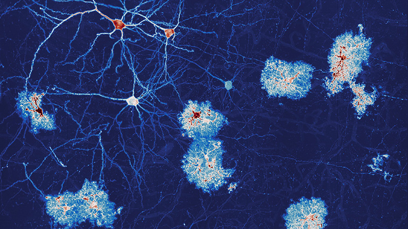 Webinar: Light-Sheet Imaging as Universal Tool for 3D Bioimaging