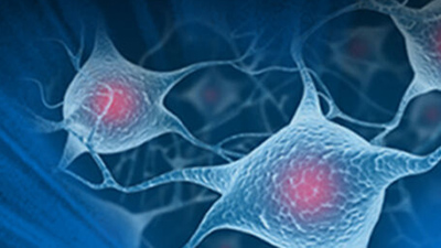 csm_Novel_Electrical_Webinar_banner_bbc4fe4724