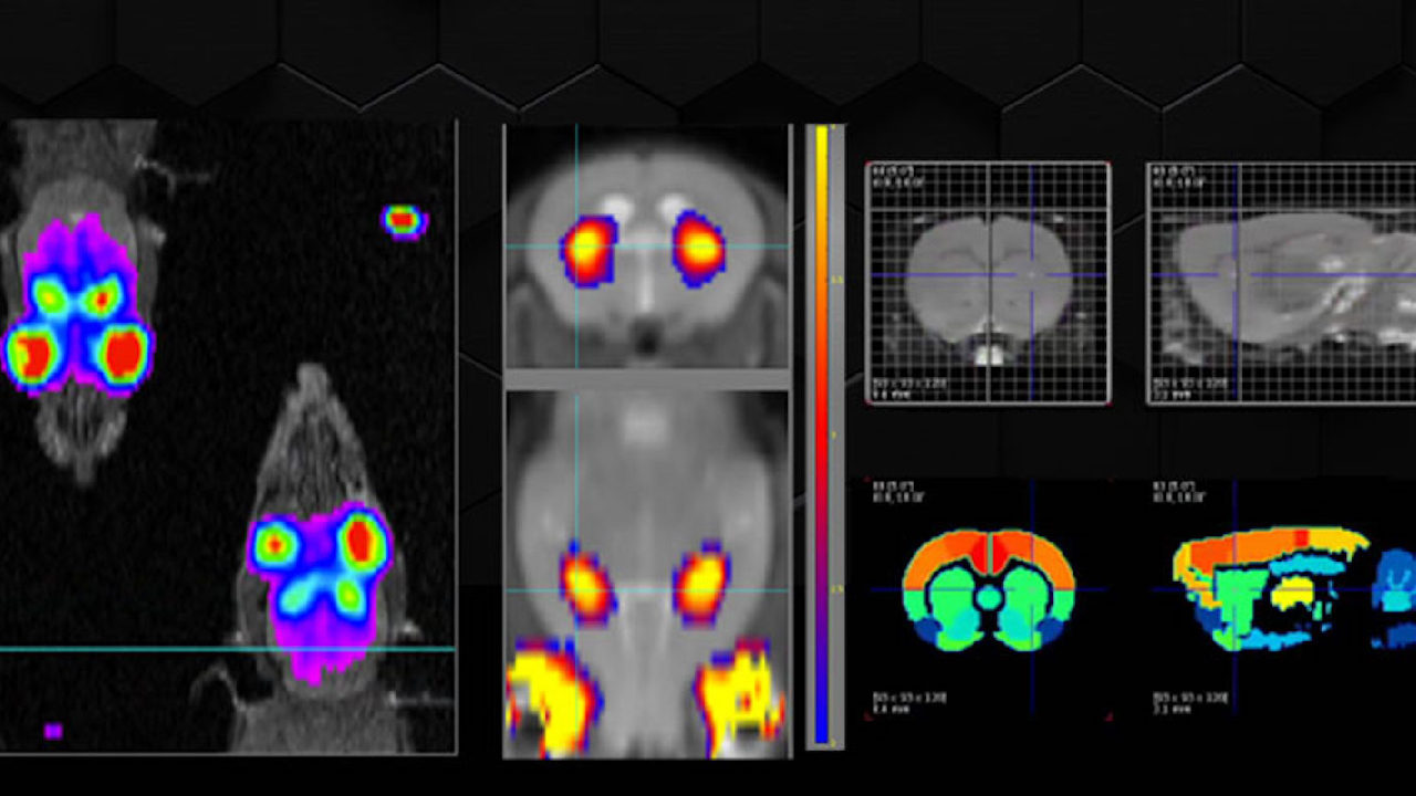 PET MRI Occupancy Studies: Basic Principles and Applications in Neuroimaging