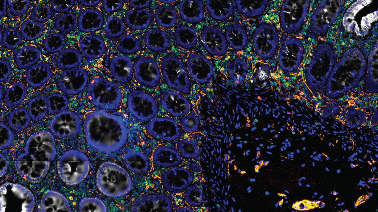 asms-spatial-multiomics