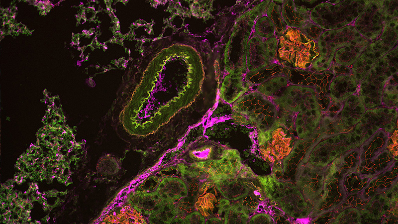 High-Throughput Screening Microscopy facilitating advanced experiments