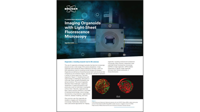 imaging-organoids-with-light-sheet