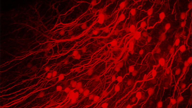 3D-view of volumetric stack recorded using the ETL focusing module. Layer 5B neurons in mouse visual cortex in vivo, labelled with tdTomato. 