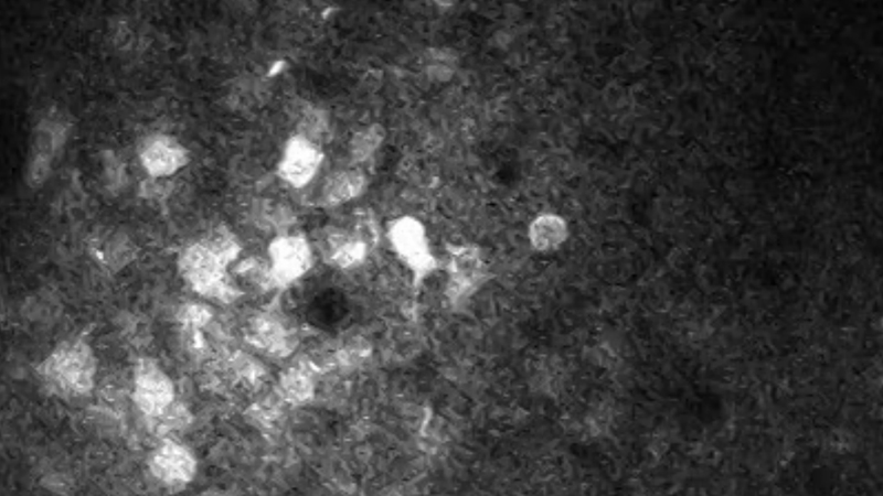 Spontaneous activity of neurons expressing activity-dependent fluorescent calcium probe in somatosensory cortex imaged with resonant galvanometer. Data courtesy of Dr. Chris Deister, Brown University