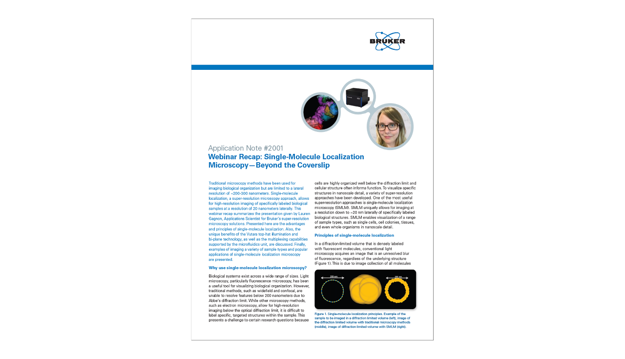 Teaser Frame - Webinar Recap Single Molecule Localization Microscopy