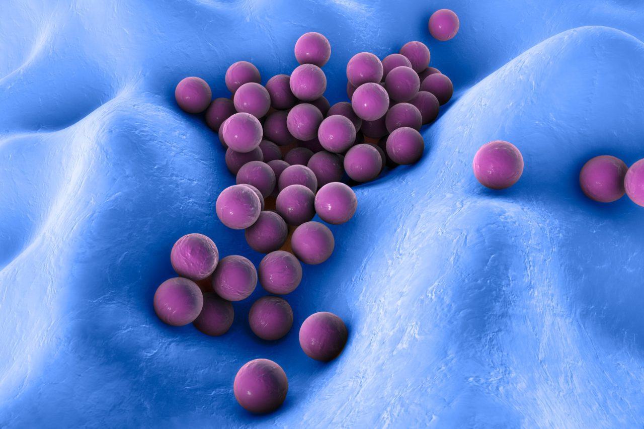 AI generated MRSA image