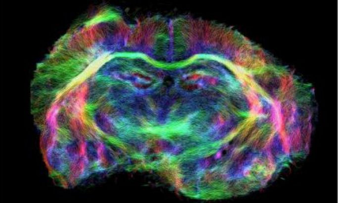 image_MR_microscopy.jpg
