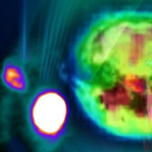 nuclear_molecular_imaging