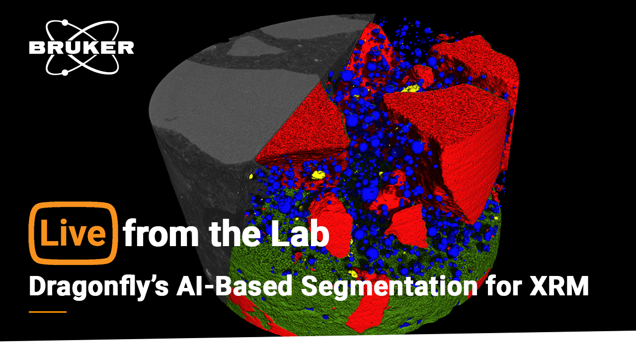 S5 E3: A Closer Look at Dragonfly’s AI-Based Segmentation for XRM