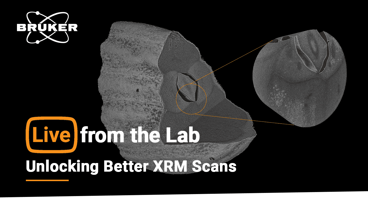 S5 E6: Unlocking Better XRM Scans