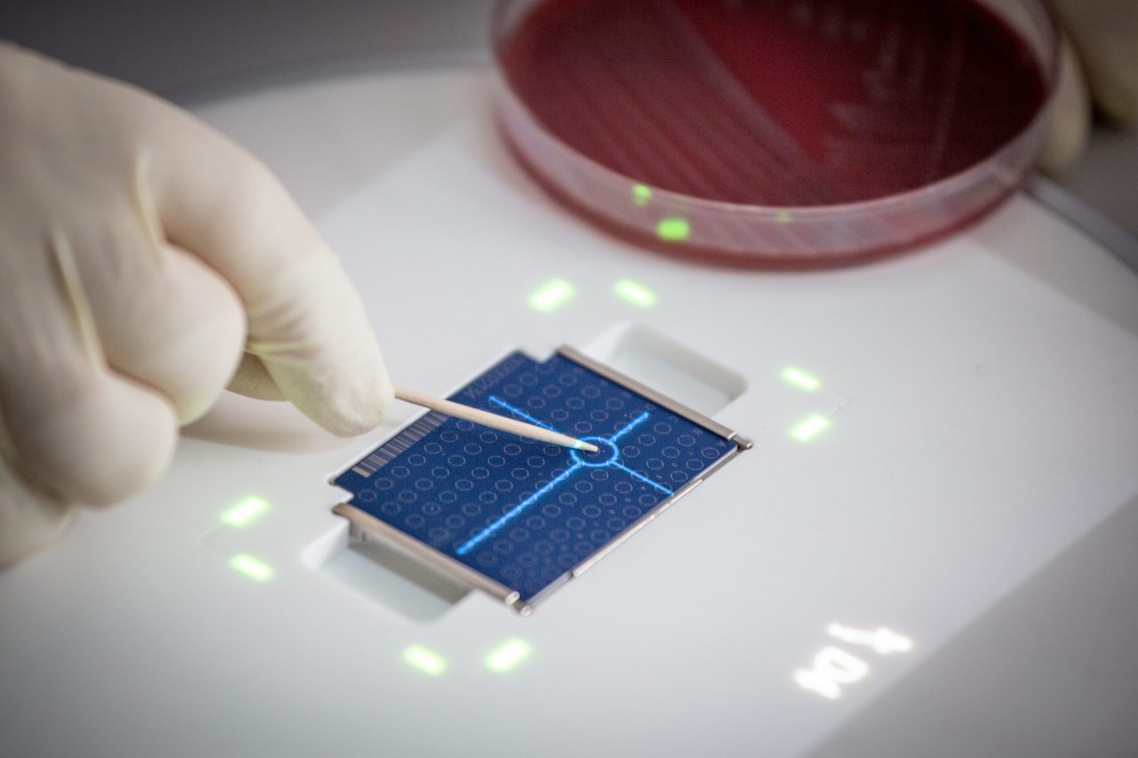 <img src="bruker.-mbt-pilot-biotarget.jpg" alt="hand smearing sample on a MBT Biotarget 96 by a toothpick"/>