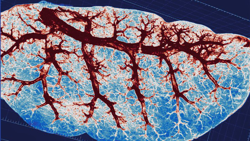 Lung tissue