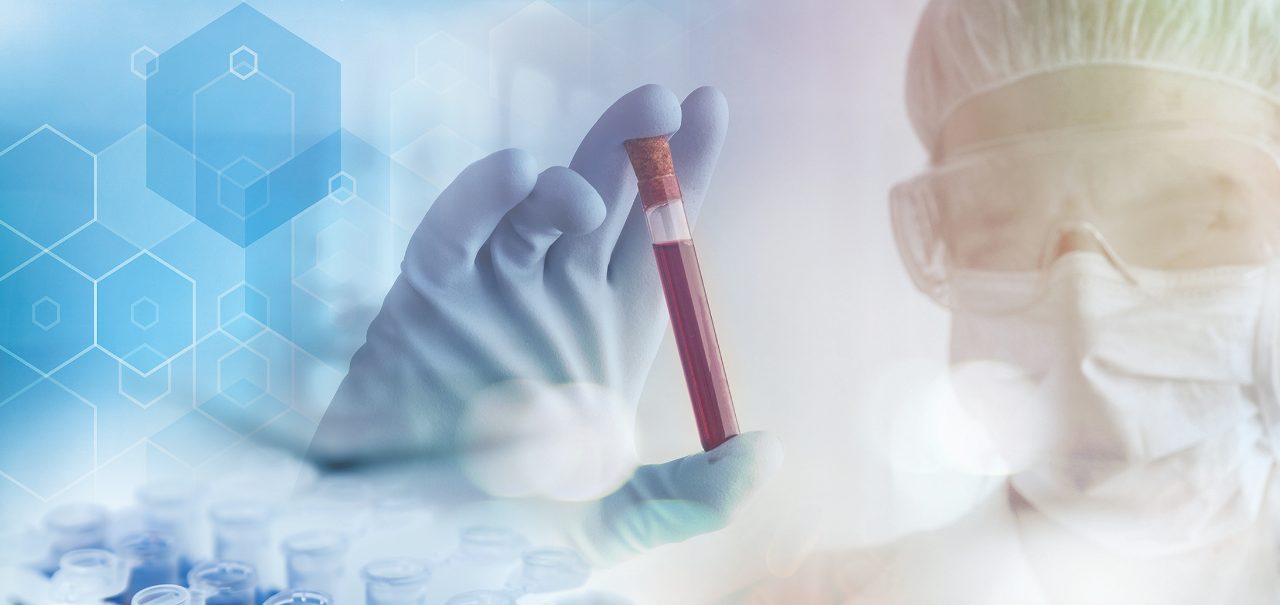 B.I. LISA - Lipoprotein Subclass Analysis