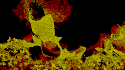 3D Imaging with Bi-Plane