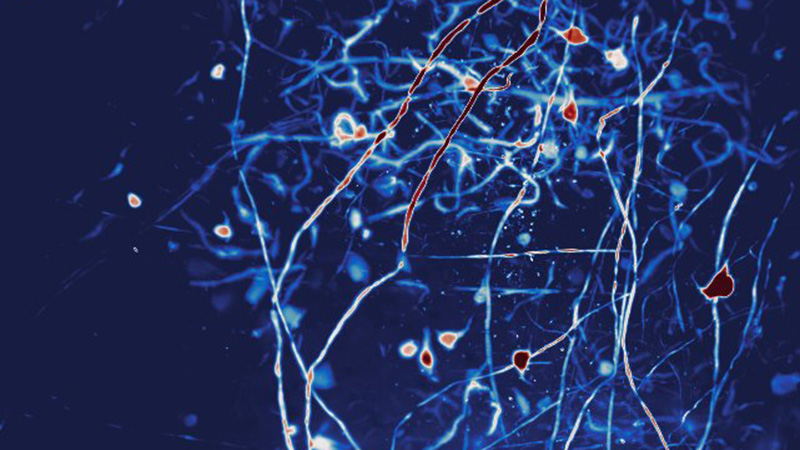 What is light-sheet microscopy?