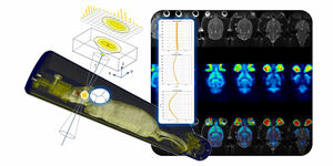 Image reconstruction is a fundamental part of PET allowing to generate 3D tomographic images of the tracer’s spatial distribution