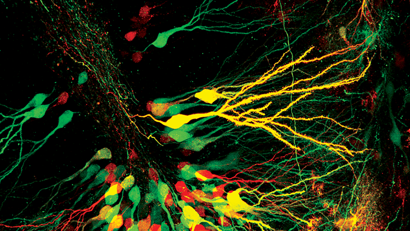 Bruker Online Neuroscience Summit 2025