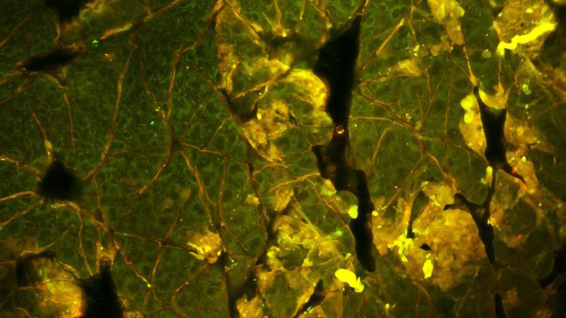 High resolution two-photon excitation fluorescence intensity image of mouse epithelium.  Intrinsic NADH fluorescence is in green, while autofluorescence from keratin is in red/yellow. 
