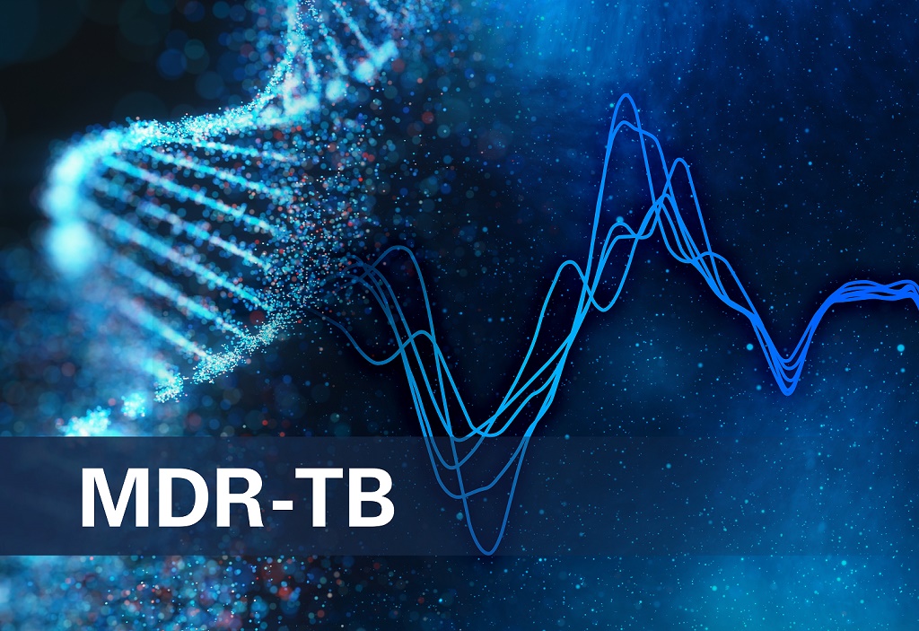 keyvisual-liquidarray-2023-mdr-tb