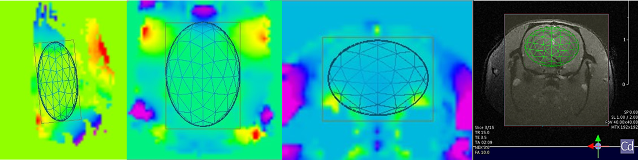 B0 homogeneity and Shim