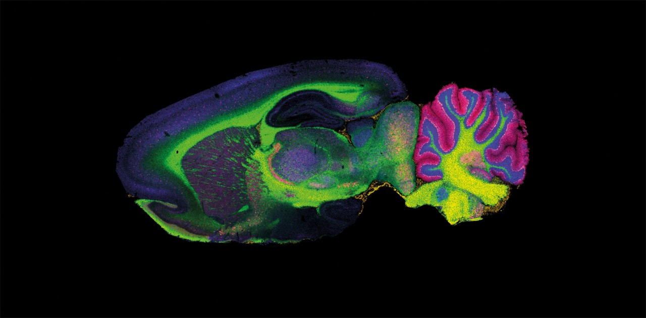 maldi-targeted-Imaging