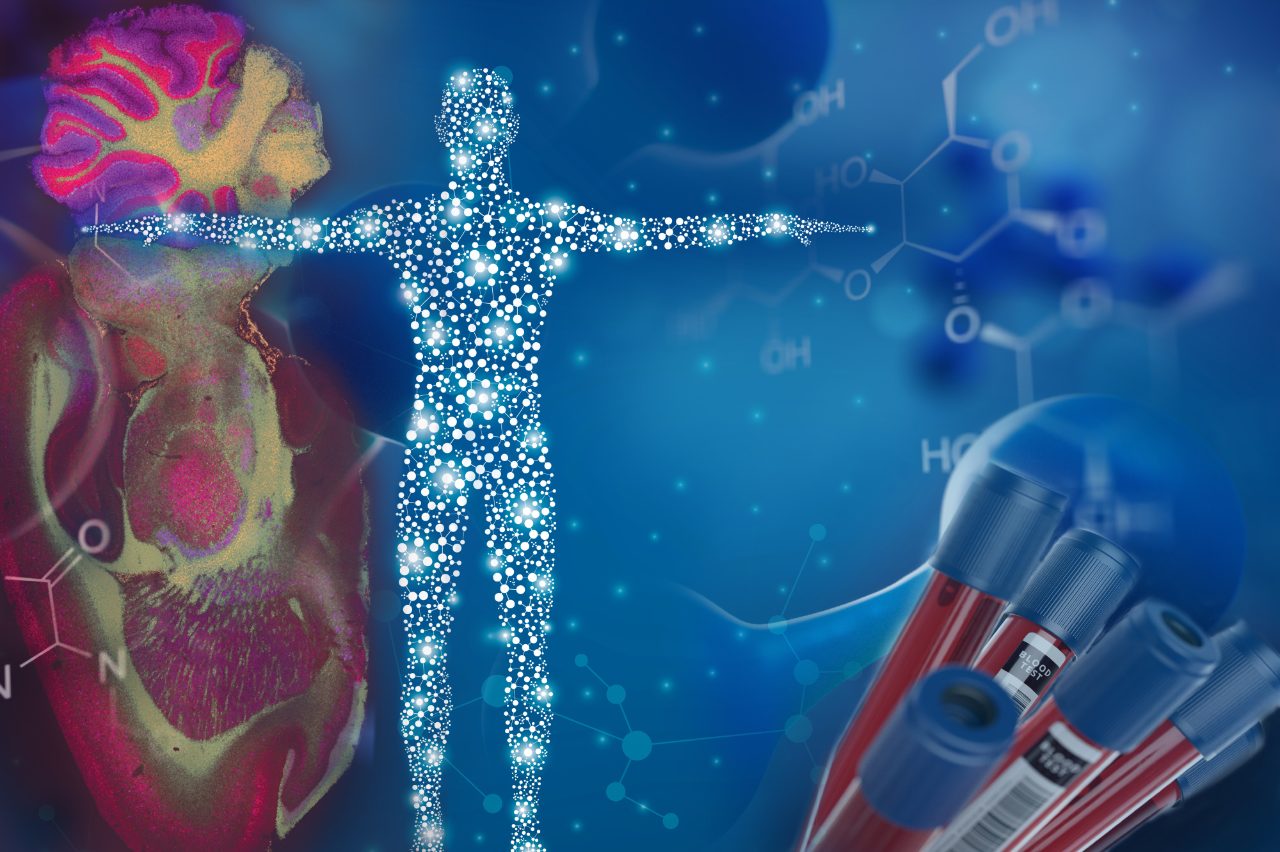 Metabolomics