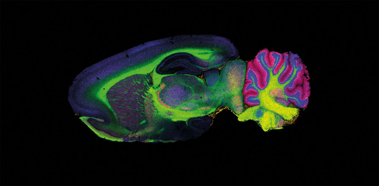 maldi-targeted-Imaging