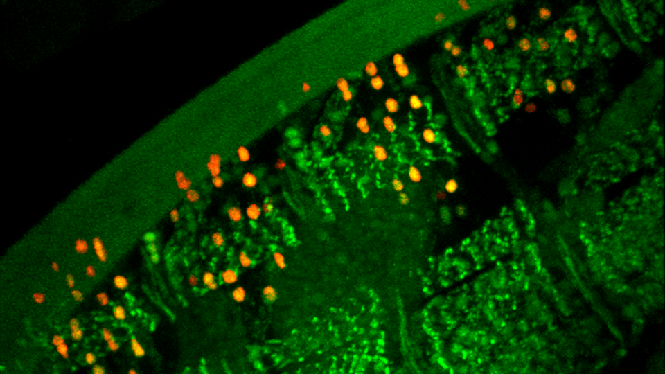 Confocal Microscopes