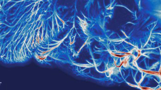 Microglia and vascular system of zebrafish imaged using light-sheet microscopy to track microglia movement.