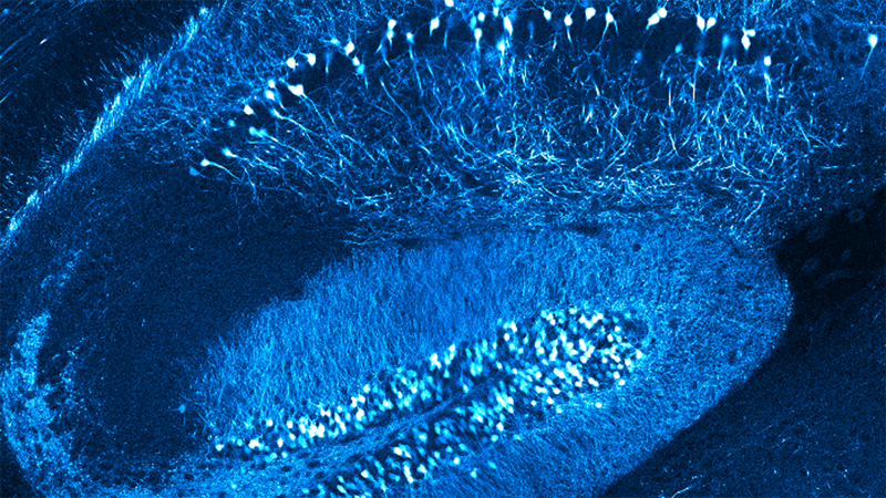 Multiphoton-microscopy