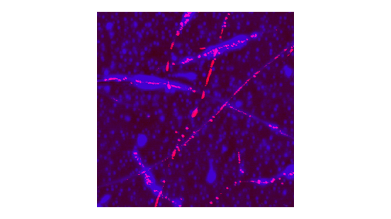 用于 AFM 的扭转谐振隧道 AFM （TR-TUNA） 模式