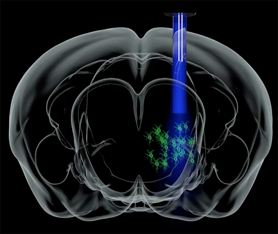 In vivo brain lens imaging of neural activity