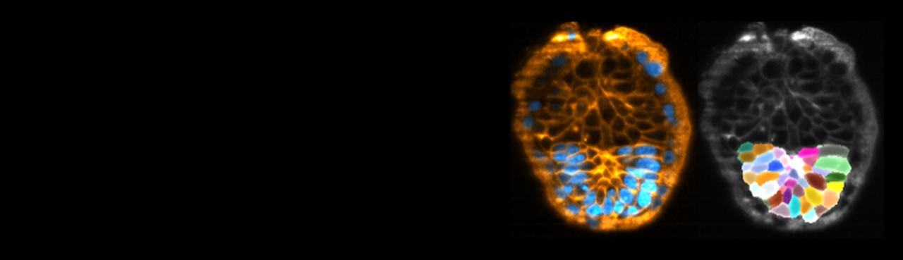Imaging Mouse Peri-Implantation Development in a 3D Ex-Vivo Culture ...
