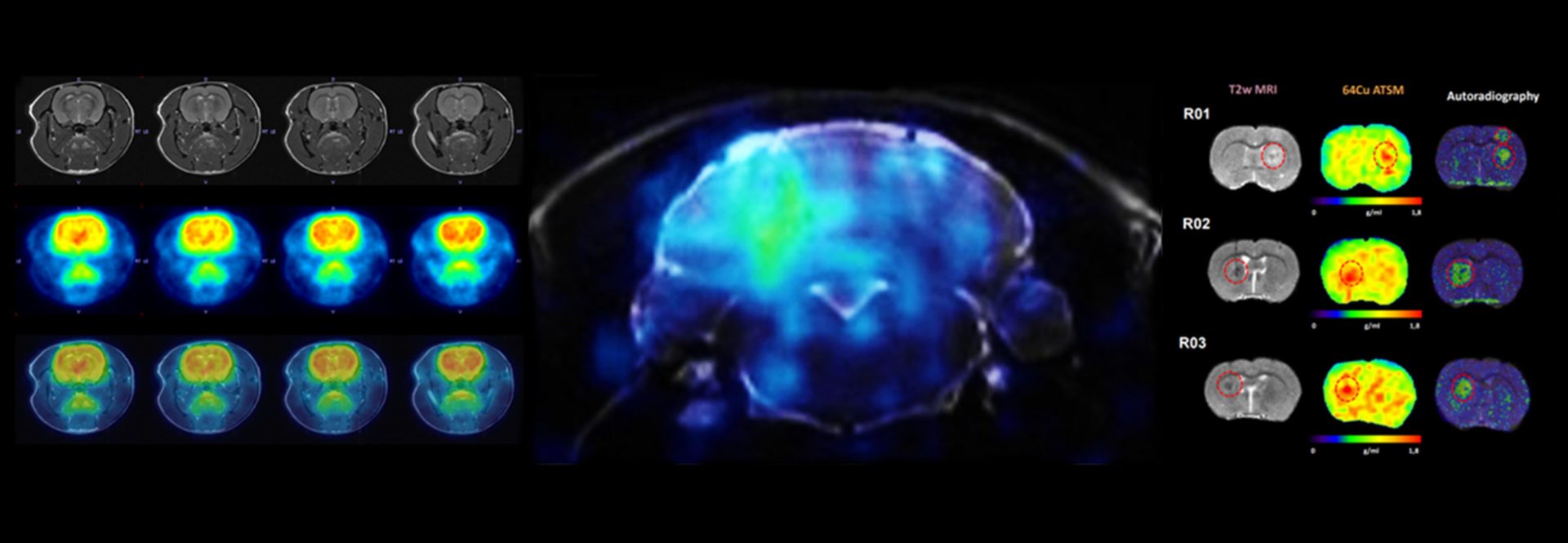 Multimodal Assessment of Hypoxia in Brain Tumors: From the Lab to the Clinic 
