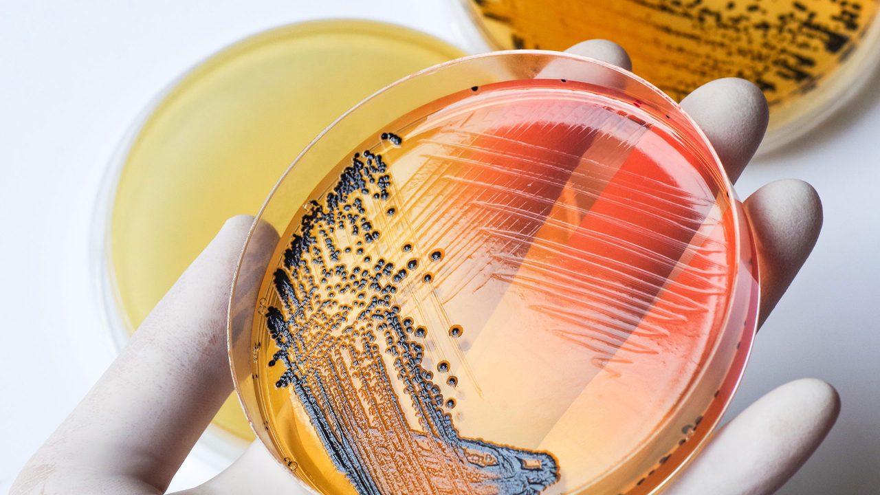 Die Hand eines Wissenschaftlers in einem medizinischen Latexhandschuh hält Bakterienkolonien in einer Petrischale vor dem Hintergrund einer Bakterienkulturplatte. Salmonellenkolonien auf einer Salmonella-Shigella-Agarplatte.