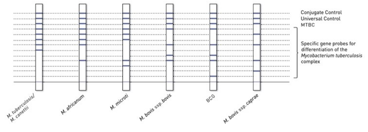 GenoType MTBC VER 1.X banding pattern showing the specific gene probes for the differentiation of the M. tuberculosis complex
