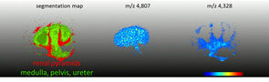 3D visualization with SCiLS lab, Oetjen et al., Journal of Proteomics, 2013