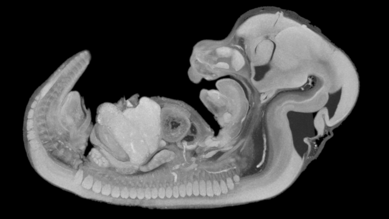 MIP slice, PTA-stained mouse, 3.7 μm voxel size