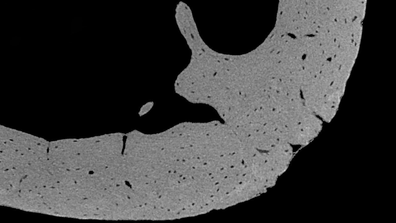 Mouse femur cortical bone imaged at 550nm voxel size visualizing mouse bone osteocytes.