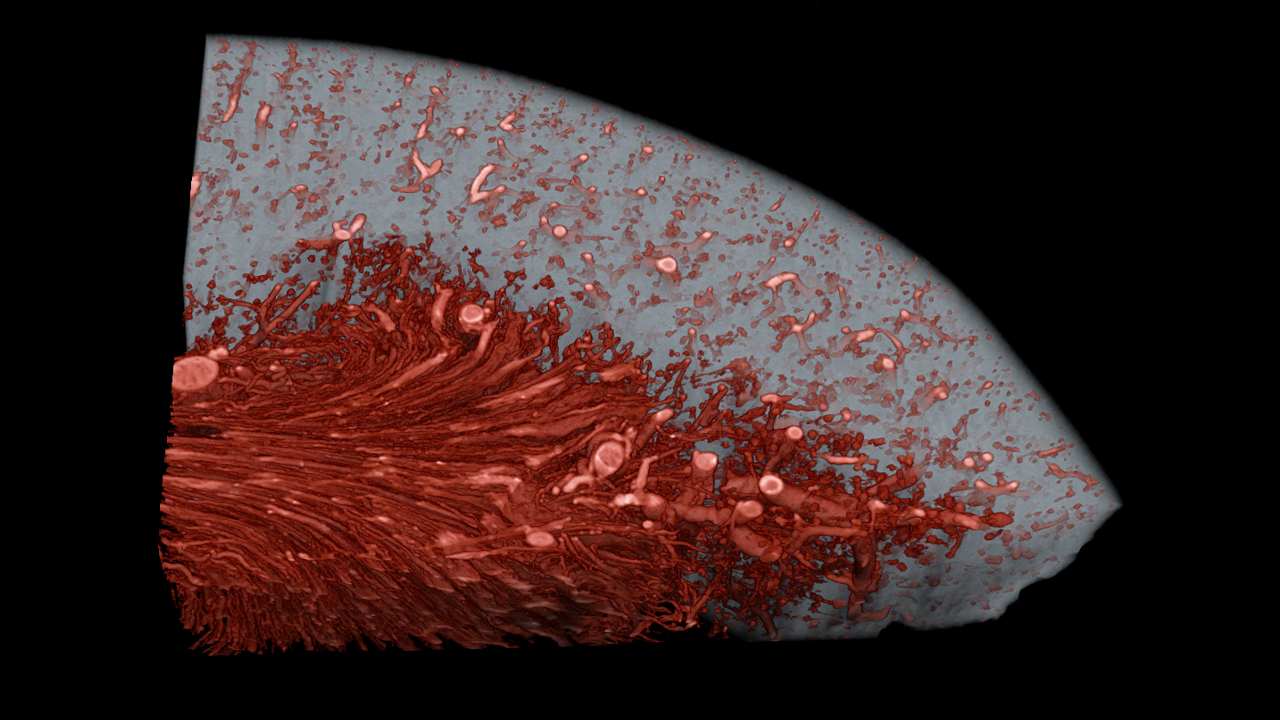 pseudo-colored 3D volume rendered rabbit kidney with blood vessels contrasted, acquired at 15 μm voxel size.