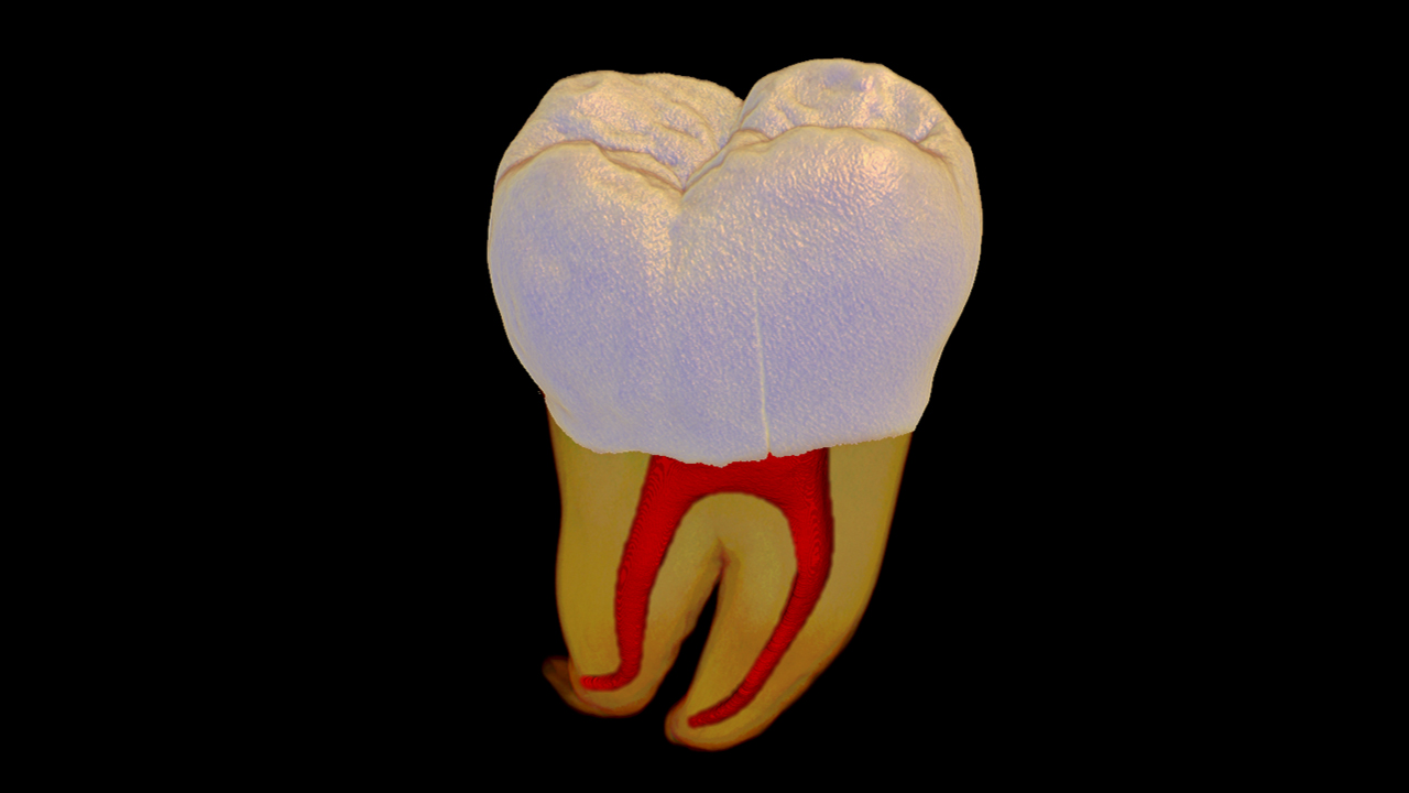 Human extracted tooth imaged at 12 μm voxel size