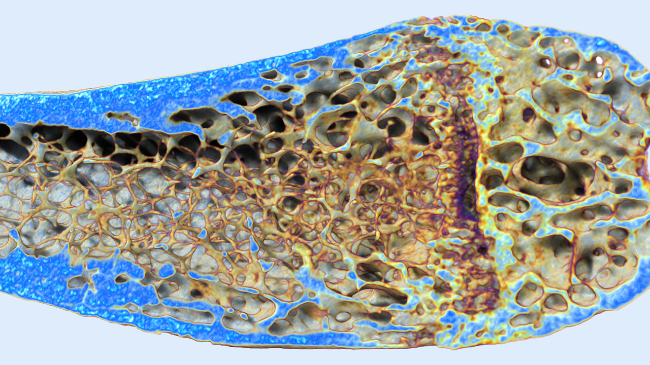 Pseudo-colored volume rendered mouse femur, 8 μm voxel size.
