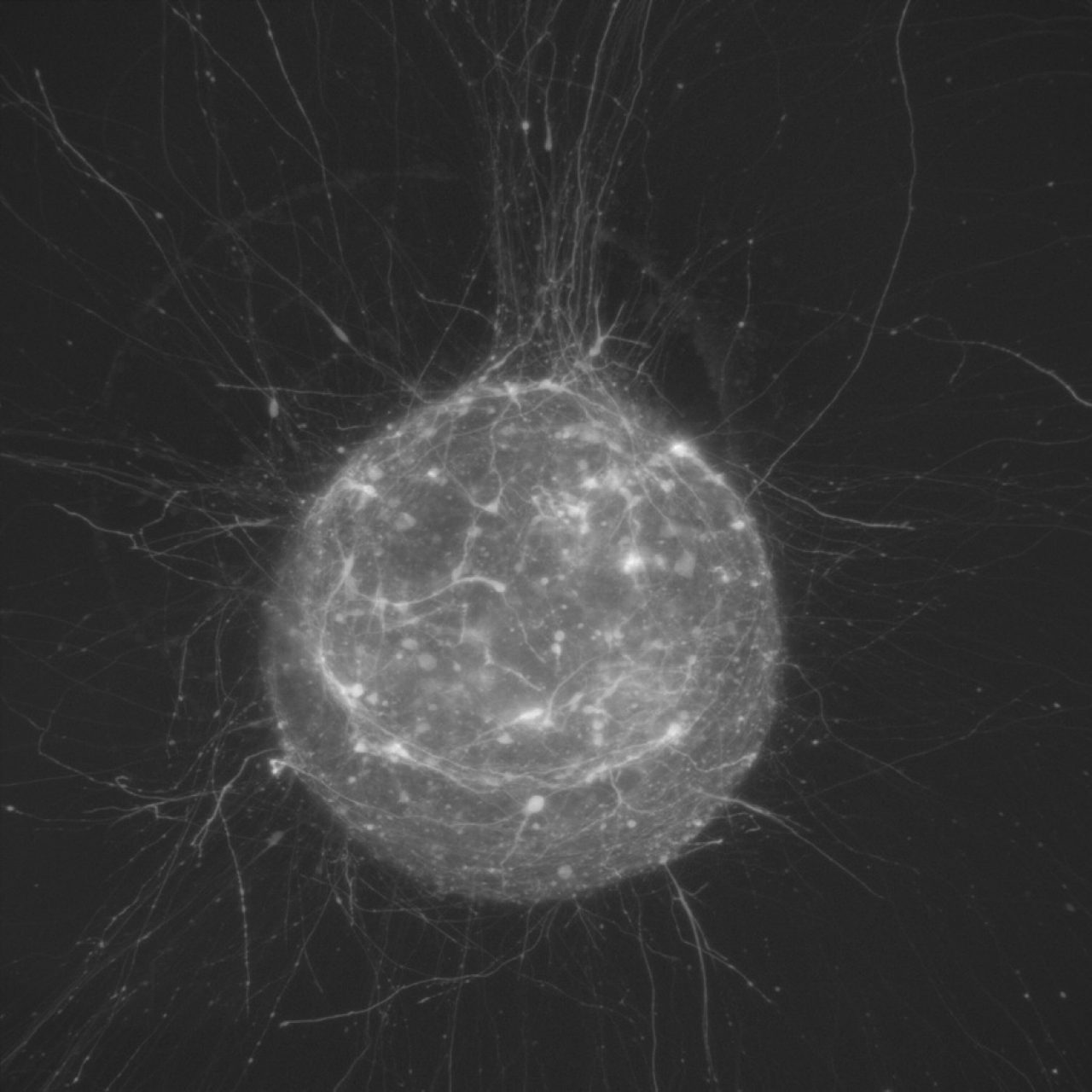 Light Microscope High Resolution Bruker Solutions for Organoid Research | Bruker
